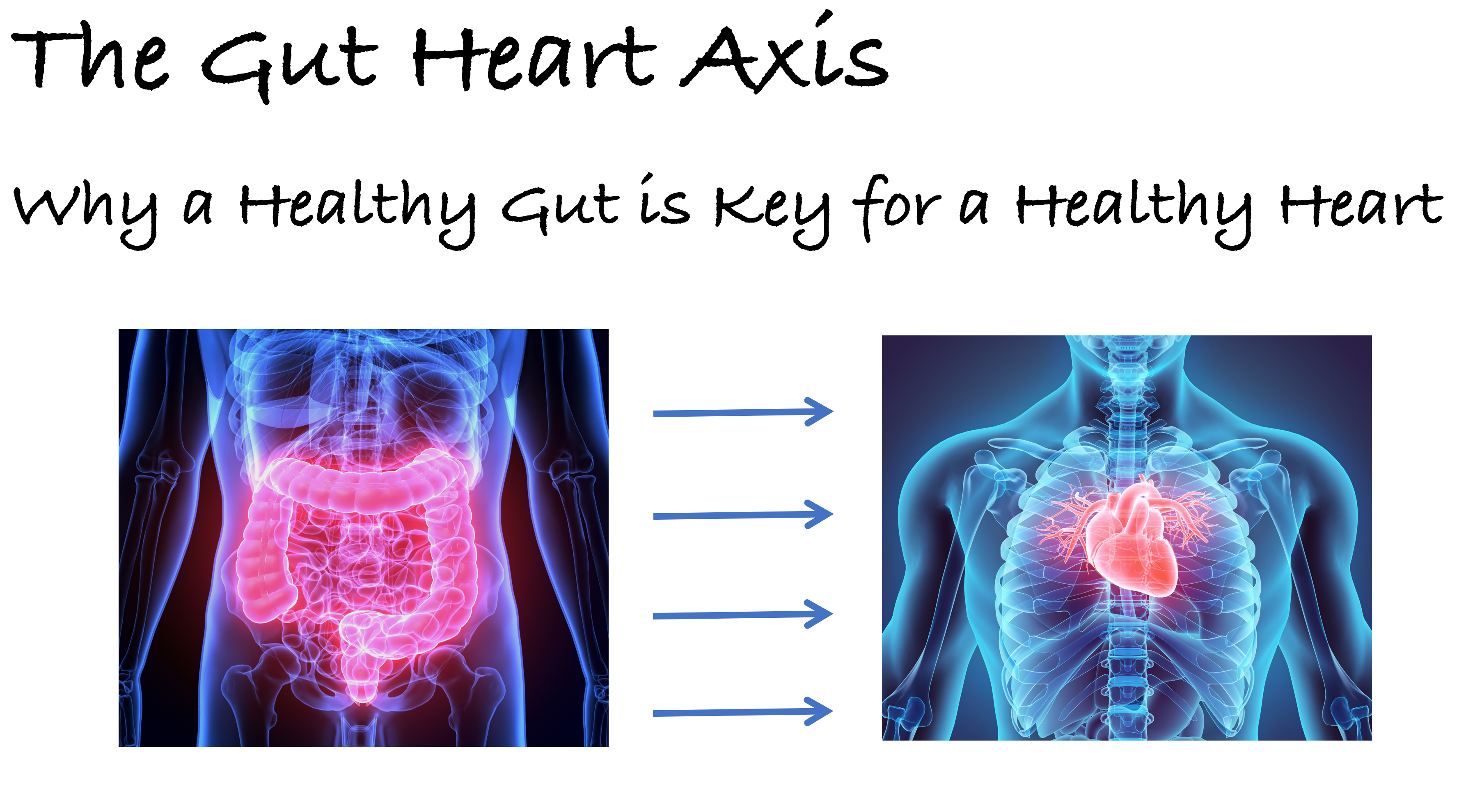 The Gut Heart Axis